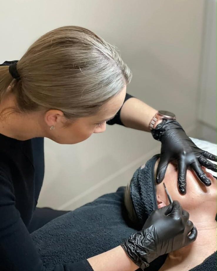 Dermaplaning treatment in progress